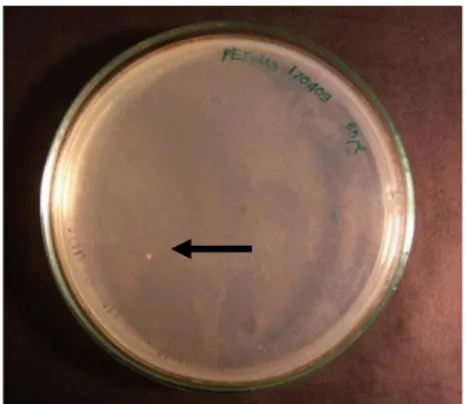 Gambar 5. Koloni yang diduga bakteri  rekombinan E. coli BL21 