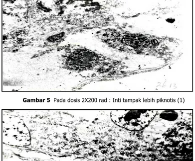 Gambar 5  Pada dosis 2X200 rad : Inti tampak lebih piknotis (1) 