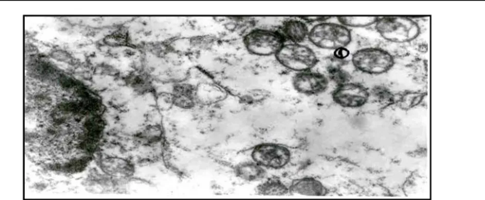 Gambar 7 Pada dosis 2X200 rad mitokhondria berbentuk bulat dengan krista yang hilang (1) 
