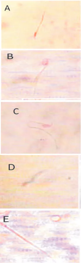 Gambar 2. Viabilitas spermatozoa; a=s permatozoa hidup dengan  warna kepala bening