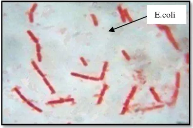 Gambar 2. Bakteri Escherchia Coli pada Biakkan dengan Perbesaran 1000x 