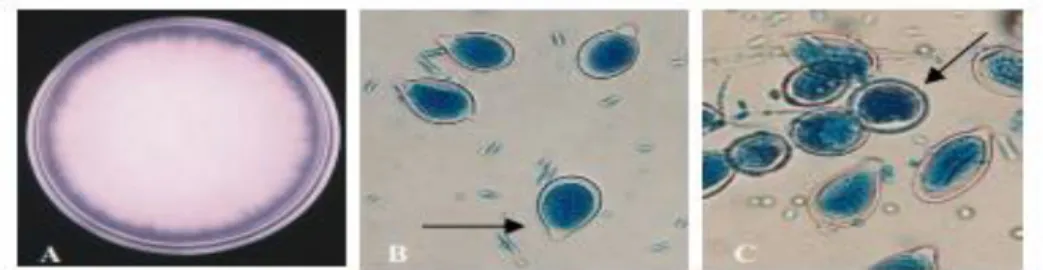 Gambar 2.A. Morfologi koloni Phytophthora sp. pada PDA umur 12 hari. 