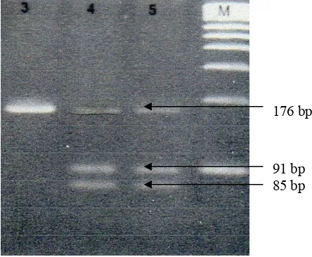 Gambar 1. Gena yang mengkode GSTP-1 