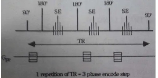 Gambar 2.3 Time Repetition atau waktu pengulangan pada Fast spin echo 