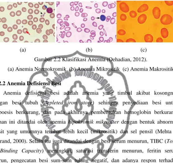 Gambar 2.2 Klasifikasi Anemia (Oehadian, 2012). 