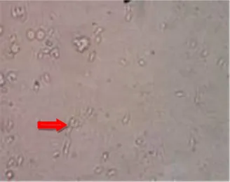 Gambar 1.      Pemeriksaan natif stadium  takizoit T. gondii dari  cairan intraperitoneal dilihat di mikroskop cahaya perbesaran  400X