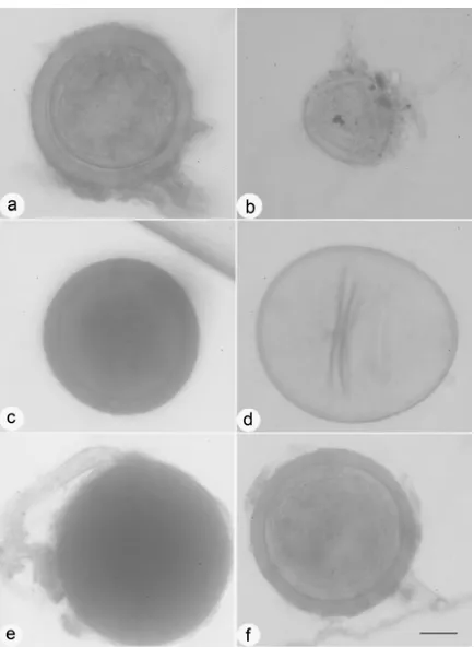 Gambar 3. Beberapa morfospesies spora FMA dari rizosfer tumbuhan (frondosayang diisolasi dari rizosfer tumbuhan di kawasan tailing