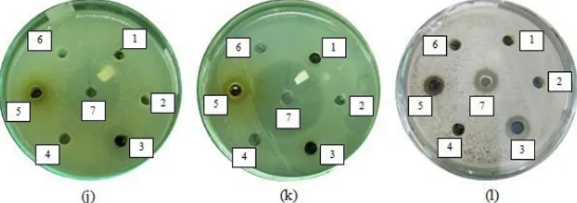 Gambar 8.1.  Diameter zona hambat; (a) ekstrak etil asetat kulit batang D. 