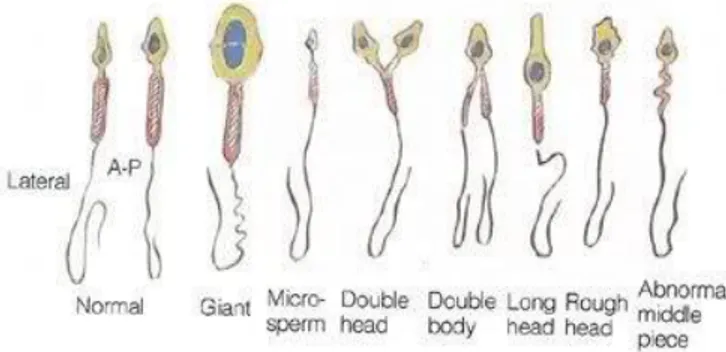 Gambar 3.2. Macam-macam jenis sperma  (Sumber: Armatage, 2013) 