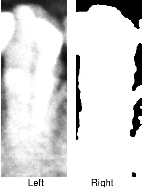 Figure 2. A dental panoramic radiograph 