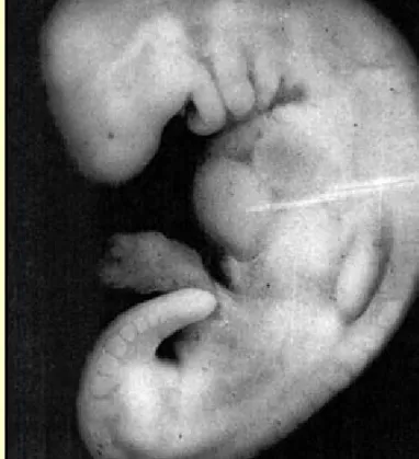                               Rajah 5: Gambar foto embrio berumur 28 hari pada peringkat mudghah