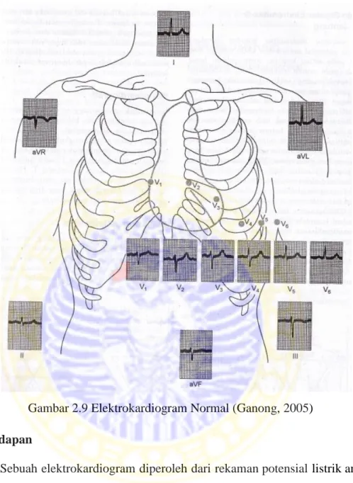 Gambar 2.9 Elektrokardiogram Normal (Ganong, 2005)