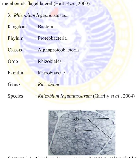 Gambar 2.4. Rhizobium leguminosarum berada di dalam bintil akar.  
