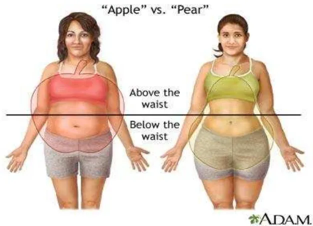 Gambar 2.3 Obesitas Apple-shaped dan Obesitas Pear-shaped. 