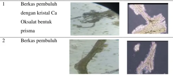 Tabel 4.5 Identifikasi Mikroskopik Daun Mangga 