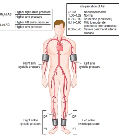 Gambar 10. Ankle-Brachial Index  46