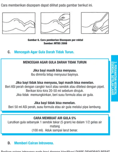 Gambar 6. Cara pemberian Diazepam per rektal Sumber: MTBS 2008