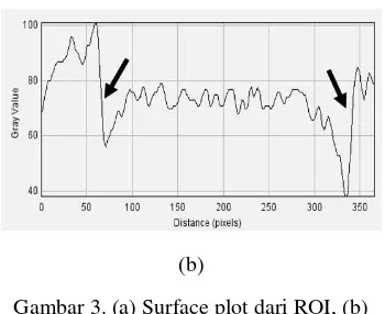 Gambar 3. (a) Surface plot dari ROI, (b) 