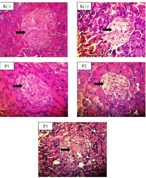 Gambar  1.  Gambaran  histopatologi  pankreas  tikus  perbesaran  400x  dengan  pewarnaan  HE  pada  perlakuan  K(-),  K(+),  P1,  P2,  P3  (              )    menunjukkan  sel  endokrin pulau Langerhans pankreas 