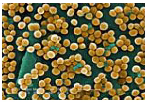 Gambar 2.7. Staphylococcus aureus 