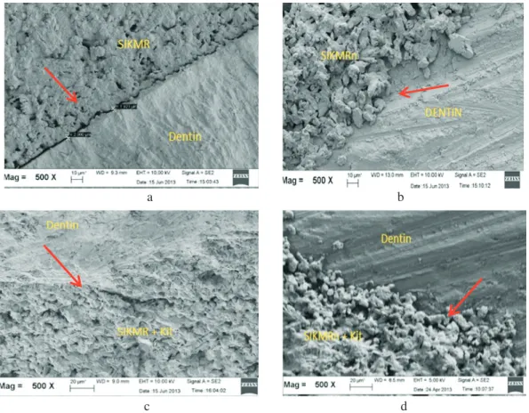Gambar 3. Gambaran permukaan antara bahan restorasi dengan dentin (pembesaran 500x). (a) SIKMR tanpa penambahan kitosan  nanopartikel; (b) SIKMRn tanpa penambahan kitosan nanopartikel; (c) SIKMR yang ditambahkan kitosan nanopartikel;  (d) SIKMRn yang ditambahkan kitosan nanopartikel dengan dentin.