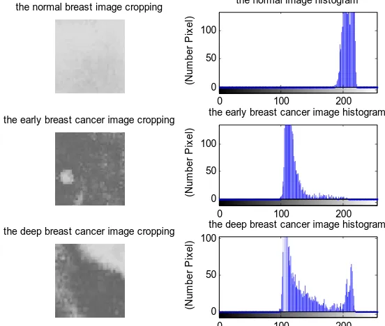 Figure 3: Cropping image grayscale (left side) and they histogram (right side) from image data N7.jpg, D3.jpg, and L2.jpg   