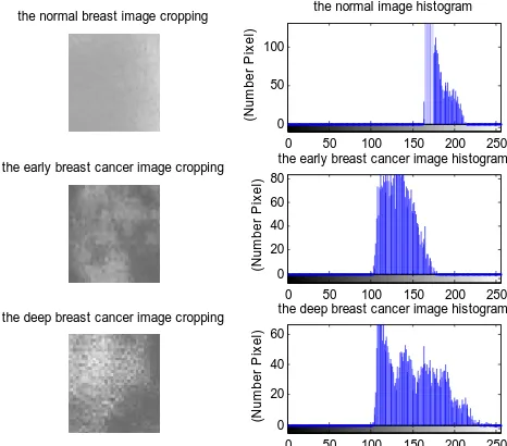 Figure 5: Cropping image grayscale (left side) and they histogram (right side)  from image data N42.jpg, D1.jpg, and L1.jpg   