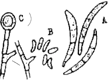 Gambar 1.15 Rosalina arcuata, Askokarp tampak dari atas (A), dan (B)                          tampak  dari samping
