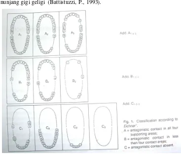 Gambar 4. Klasifikasi Eicher’s (Battistuzzi, P., 1993) 