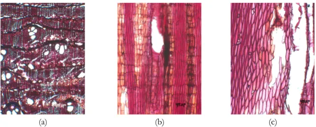 Gambar 2.  Struktur mikroskopis kayu Pisonia umbellifera pada (a) penampang melintang (b)  radial dan (c) tangensial
