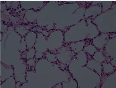 Gambar 7. Histopatologis Paru-paru setelah perlakuan (P3) perbesaran 400x Tampak kerusakan berat pada struktur dinding bronkhiolus atau alveolus.