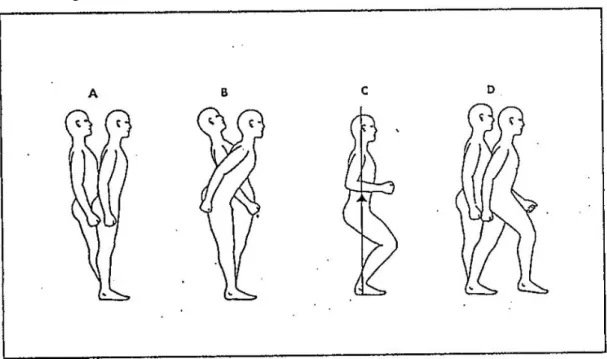 Gambar  2.2  Strategi  postural  reaktif  A.  Strategi  pergelangan  kaki,  B.  Strategi  pinggul, C