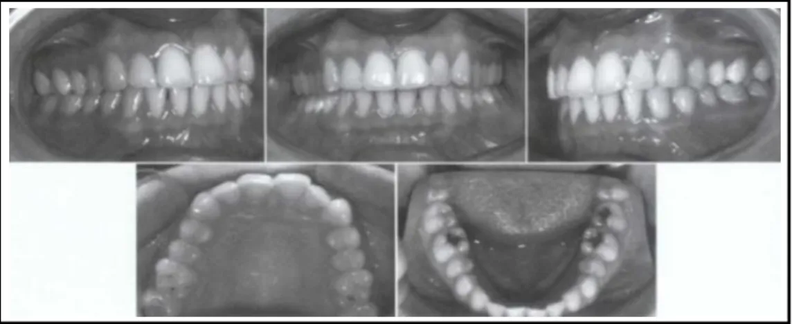 Gambar 6. Oklusi normal 24