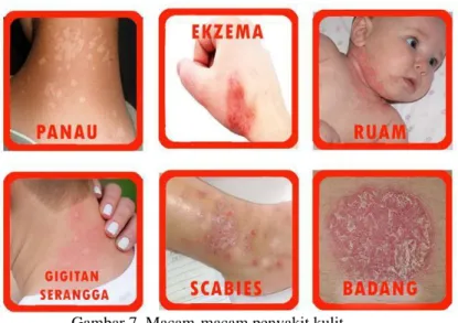 Gambar 7. Macam-macam penyakit kulit 