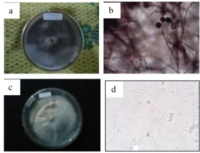 Gambar  7    Cendawan  Endofit.  a)  makroskopik  Nigrospora  sp.,  b)  mikroskopik  Nigrospora  sp.,  c)  makroskopik  Acremonium  sp.,  d)  mikroskopik  Nigrospora sp