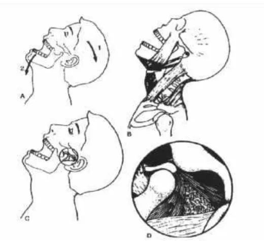 Gambar 2. (a) Posisi normal mandibula (b) Otot-otot