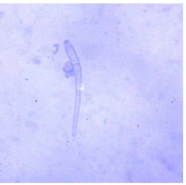 Gambar 2. Mikroskopis Corynespora cassiicola (Berk.& Curt.) Wei Sumber : Foto langsung 