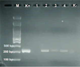 Gambar 1. Hasil amplifikasi DNA sampel mencit perlakuan dua hari sesudah infeksi menggunakan primer spesifik gen surface antigen-1 Toxoplasma gondii pada agarose 1,5%