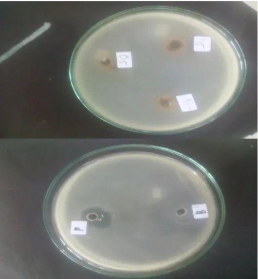 Lampiran 20. Gambar hasil pengujian aktivitas antibakteri  gel  ekstrak   Teh hijau (Camelia sinensis L.) terhadap Escherichia coli 