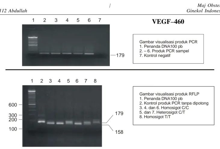 Gambar visualisasi produk  1. Penanda DNA100 pb roduk PCR  . Kontrol negatif PCR2. – 6