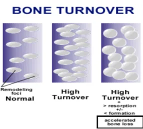 Gambar inipun memberikan suatu  ilustrasi bahwa pada saat remodelling tulang  maka  tampak  terjadi  percepatan  pembetukan  tulang  dan  pada  saat  terjadi  bone  turn  over yang tingg  yaitu suatu keadan  proses  resopsi  tulang  lebih menonjol dibandin