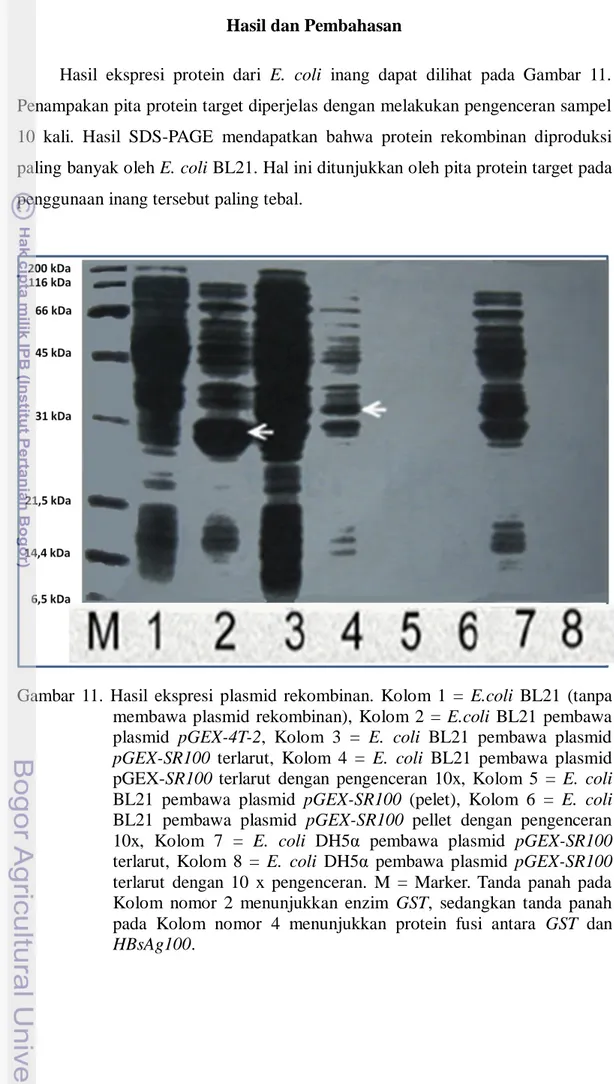 Gambar  11.  Hasil  ekspresi  plasmid  rekombinan.  Kolom  1  =  E.coli  BL21  (tanpa  membawa  plasmid  rekombinan),  Kolom  2  =  E.coli  BL21  pembawa  plasmid  pGEX-4T-2,  Kolom  3  =  E