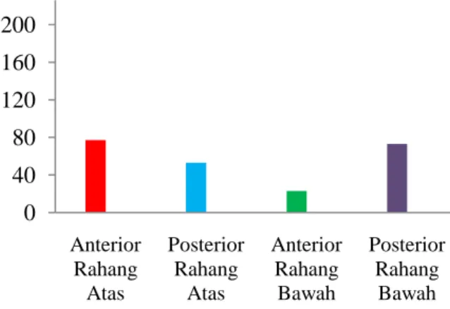 Gambar  13.  Distribusi frekuensi  responden  yang menggunakan bahan tumpatan  SIK   berdasarkan regio gigi tahun 2013