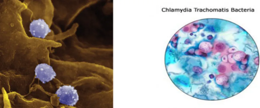 Gambar II.2. Klamidia trachomatis 4 