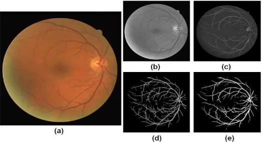 Figure 2. The step by step outputs of proposed system; a) original colored retinal image; b) 