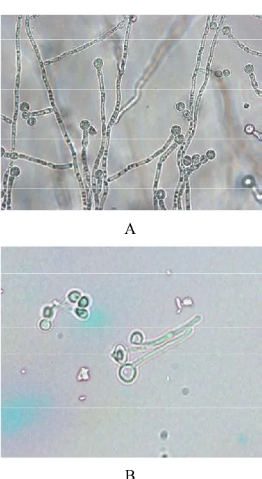 Gambar 2.1. Candida albicans. : A. Bentuk klamidospora pada cornmeal 