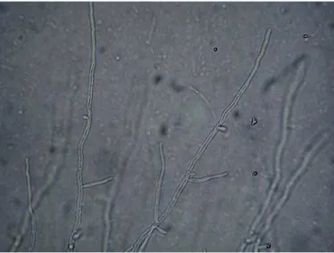 Gambar 2.4. Mikroskopis dari Candida parapsilosis pada agar cornmeal 14 