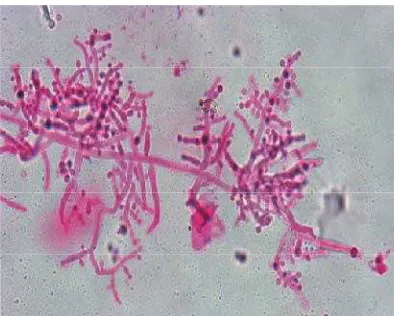 Gambar 2.6. Mikroskopis Microsporum gypseum.14
