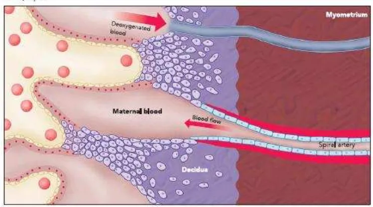 Gambar 2.3  Arteri Spiralis pada Kehamilan dengan Preeklampsia 