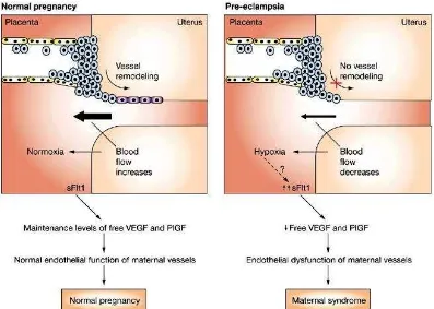 Gambar 2.8  Proses Mekanisme Disfungsi Endotel pada Preeklampsia (Norris, 2005) 